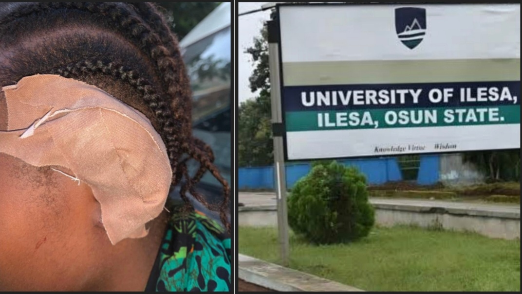 The UNI-ILESA attack and how it happened